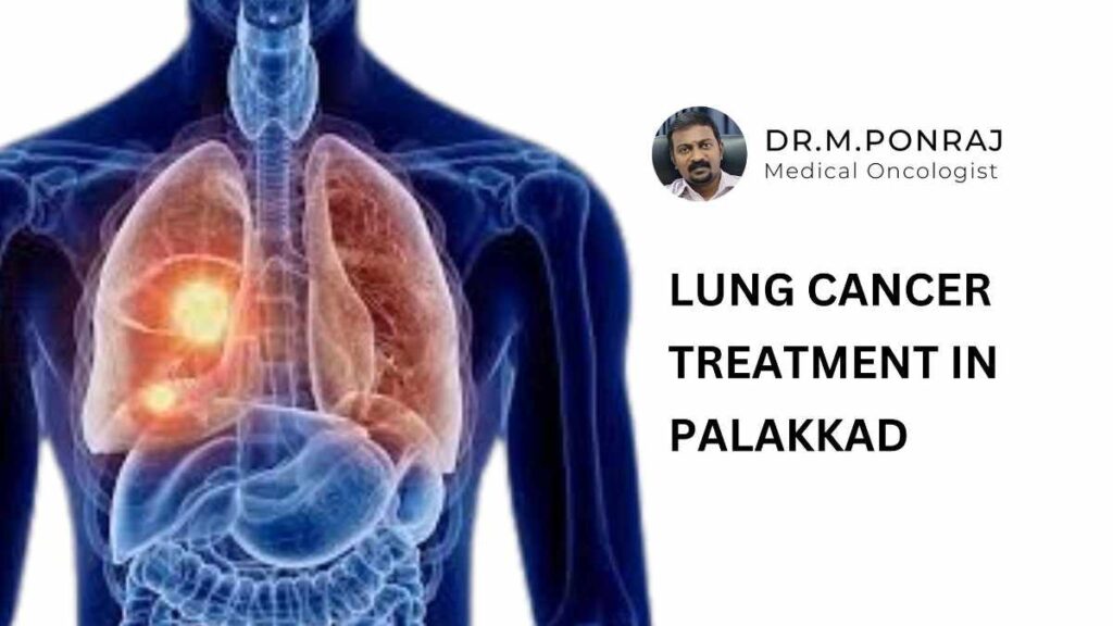 Advanced lung cancer treatment in Palakkad with personalized care plans and cutting-edge technologies for better patient outcomes.